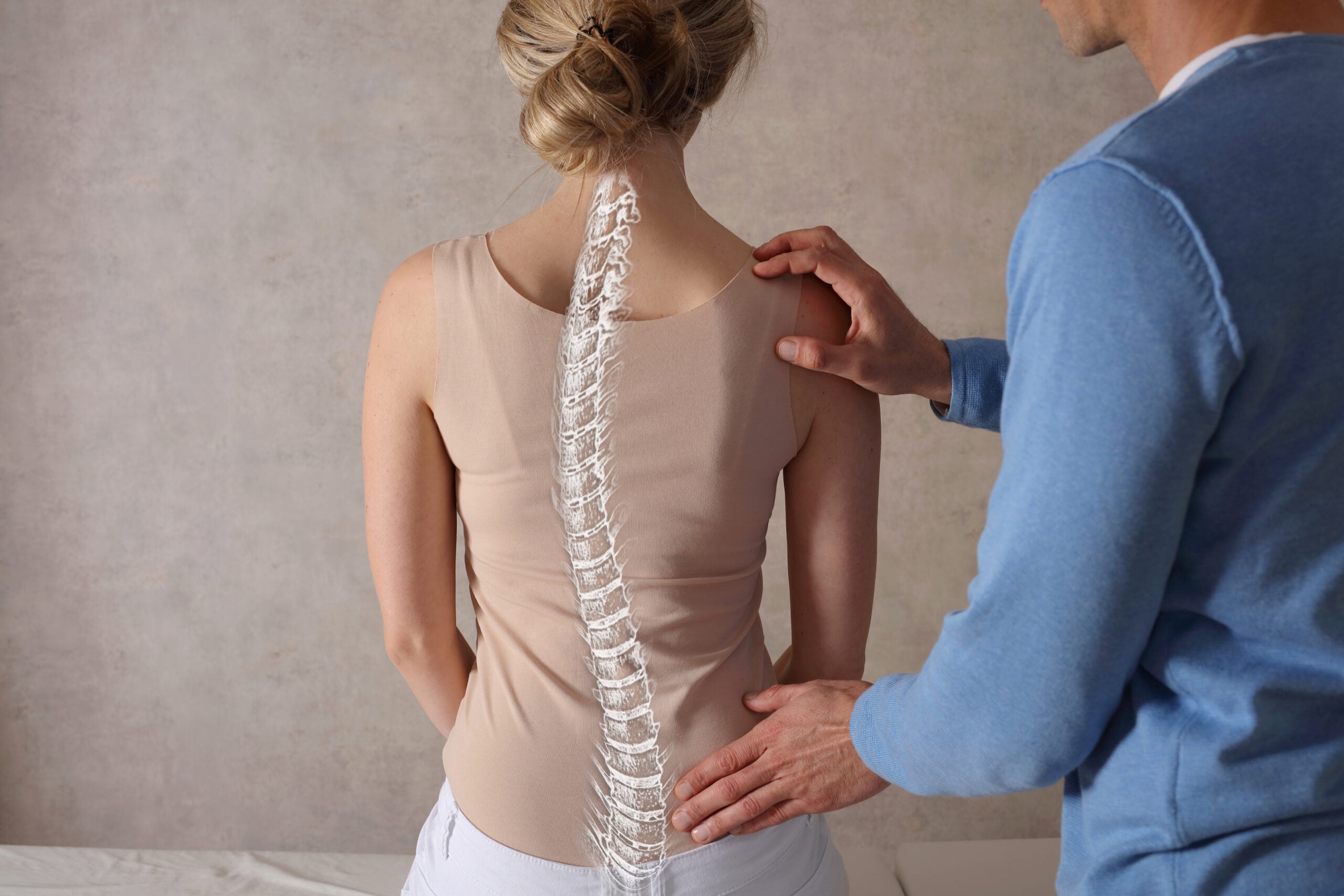 Person with scoliosis spinal curvature needing specialized treatment in Campbell